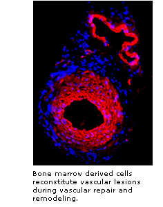 Bone marrow derived cells reconstitute vascular lesions during vascular repair and remodeling