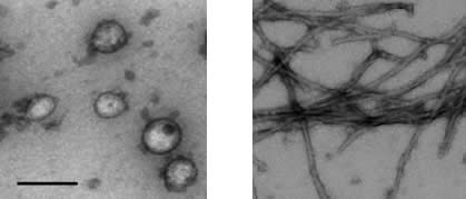 Electron micrograph images of isolated mouse synaptic vesicles (left)  fibrils of aggregated α-synuclein (right). Scale bar 100 nm