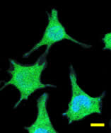 Confocal microscopy image of fixed M17 neuroblastoma cells. Green = G7C-fluorescein labeled α-synuclein. Blue = nuclear DNA stained with DAPI. Bar = 10 microns.