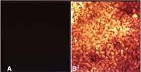 Levels of intracellular hydrogen peroxide as assesed by DCF fluorescence in vascular smooth muscle cells