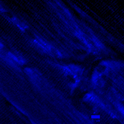 This is an image of NAD(P)H fluorescence of the tibialis anterior of a living mouse taken with two-photon microscopy (pixel size of 0.26 um, excitation 720 nm, emission centered around 450nm). 