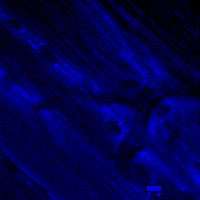 NAD(P)H fluorescence of the tibialis anterior of a living mouse.