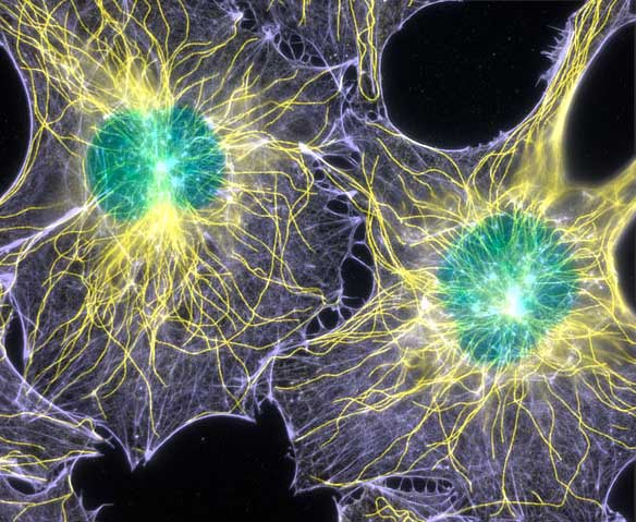 Fluorescence image of filamentous actin and microtubules in mouse fibroblasts cell.