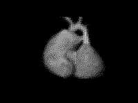 MRI of Fetal Mouse Heart. 