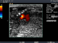 Ultrasound of Fetal Mouse Heart.