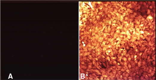Levels of intracellular hydrogen peroxide as assesed by DCF fluorescence in vascular smooth muscle cells A) before or B) 5 minutes after platelet derived growth factor (PDGF) stimulation.