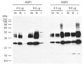 AQP1 and AQP2 immunoblot of whole inner medulla, non-IMCD, and IMCD homogenates